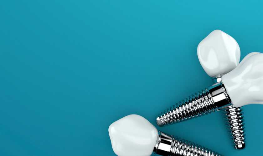Exploring Advanced Dental Implant Technologies