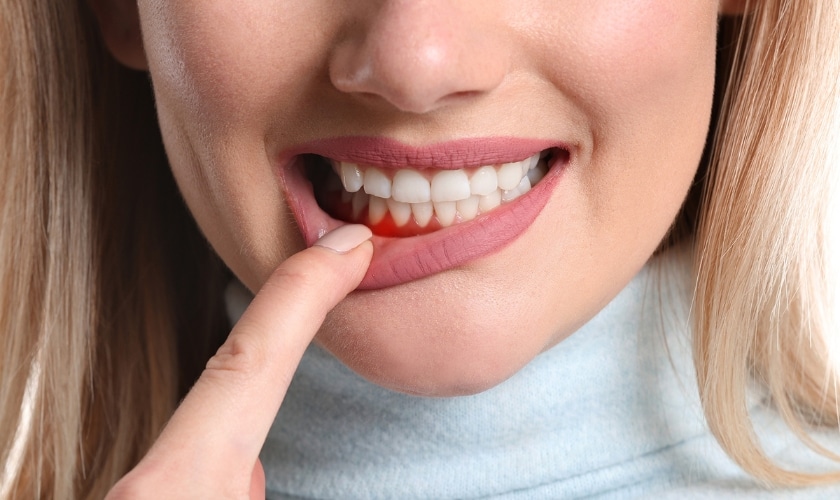 Featured image for “What is the best antibiotic for gum infection?”
