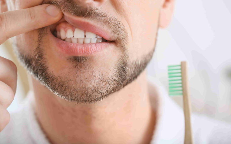 Gum Disease Treatment