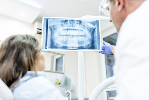 A dentist wearing gloves is showing a dental X-ray to a patient. The X-ray is displayed on a monitor, and it shows a clear image of the patient's teeth and jaw. The patient is seated and looking at the screen, while the dentist points to the X-ray.